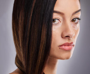What is Skin Discoloration a Sign of?